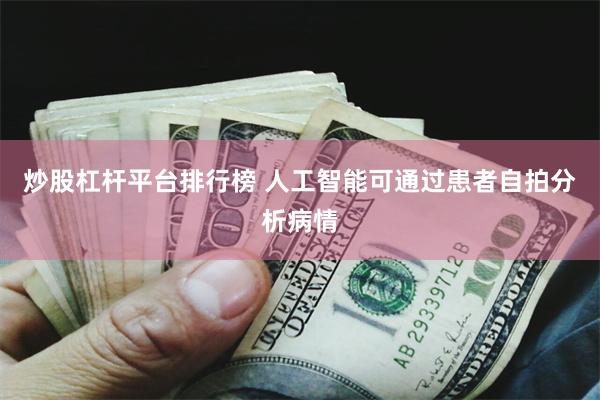 炒股杠杆平台排行榜 人工智能可通过患者自拍分析病情